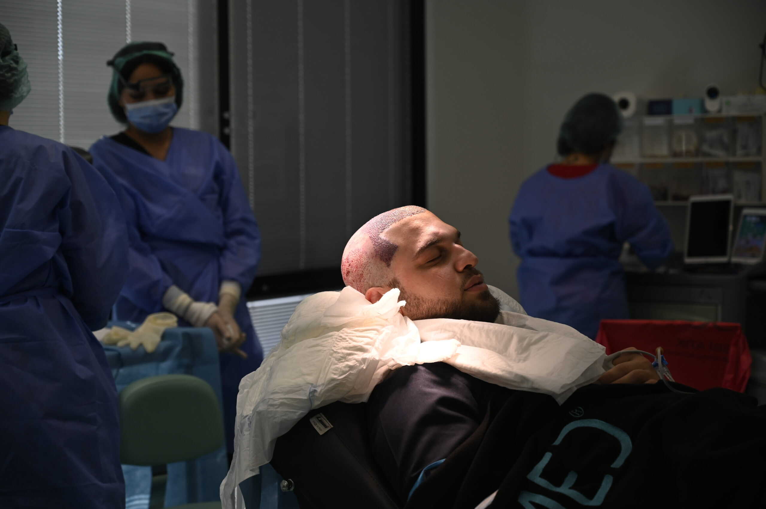 Haartransplantation in der Türkei: Das Geschäft mit der Glatze